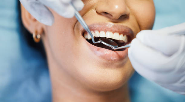 Best Emergency Root Canal Therapy in Greenbriar, VA