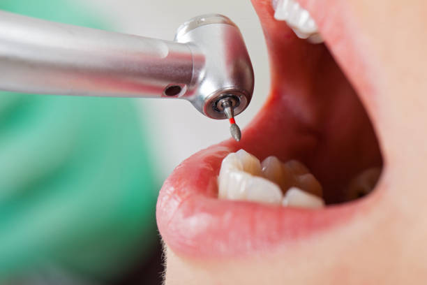 Best Walk-In Emergency Dental Services in Greenbriar, VA